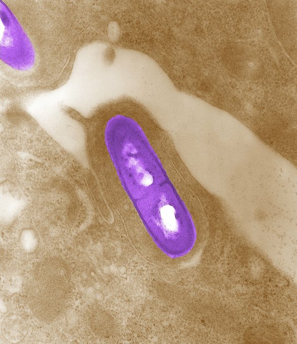 More than 22,000 pounds of chicken, ham and beef products are being recalled because of possible Listeria contamination, the U.S. ... More than 22,000 pounds of chicken, ham and beef products are being recalled because of possible Listeria contamination, the U.S. ...