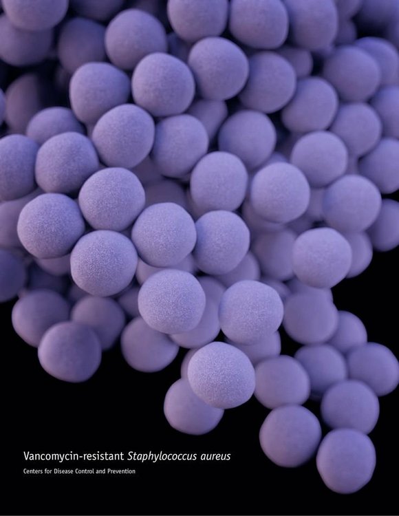 Health officials have long been warning us about the overuse of antibiotics and the rise of drug-resistant "superbugs." Now the ... Health officials have long been warning us about the overuse of antibiotics and the rise of drug-resistant "superbugs." Now the ...