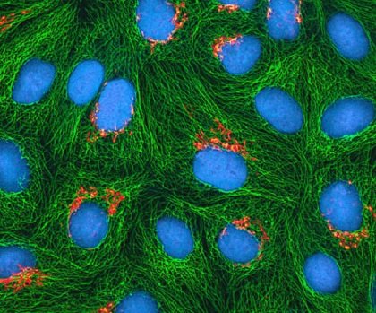 On Wednesday the National Institutes of Health announced in Nature that it has reached an understanding with the family of ... On Wednesday the National Institutes of Health announced in Nature that it has reached an understanding with the family of ...