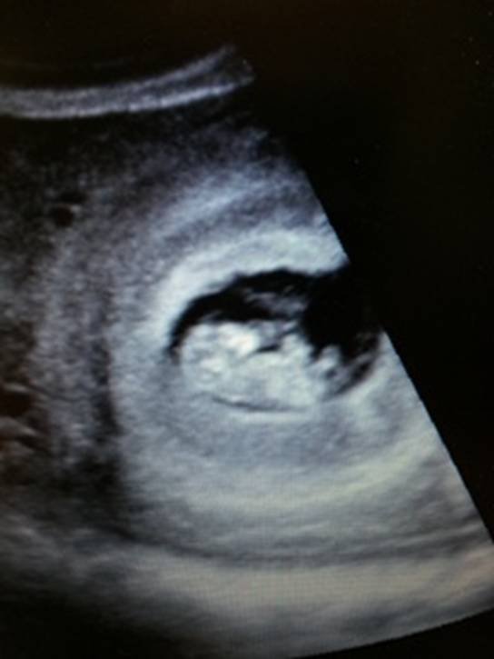 Seven months of pregnancy down, 15 to go. That’s the good news the Oklahoma City Zoo shared publicly after an ... Seven months of pregnancy down, 15 to go. That’s the good news the Oklahoma City Zoo shared publicly after an ...