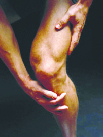 Nearly 40 million Americans — or one in every seven people — have arthritis. And while the condition affects people ... Nearly 40 million Americans — or one in every seven people — have arthritis. And while the condition affects people ...
