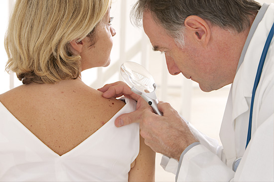 Image result for skin cancer check up