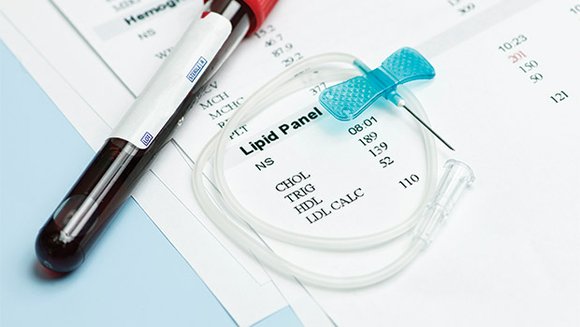 It is recommended that screening for cholesterol begin at age 20 and be repeated every three to five years. Those ... It is recommended that screening for cholesterol begin at age 20 and be repeated every three to five years. Those ...