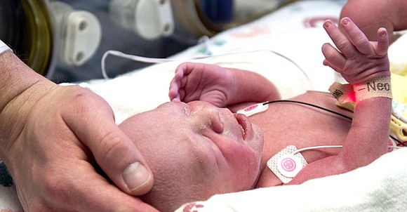 The first birth as a result of a womb transplant in the United States occurred in Dallas, a milestone for ... The first birth as a result of a womb transplant in the United States occurred in Dallas, a milestone for ...