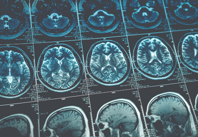 The nation’s first African-American Neuroscience Research Initiative, aimed at ensuring that genomic research and neuroscience studies are representative of individuals ... The nation’s first African-American Neuroscience Research Initiative, aimed at ensuring that genomic research and neuroscience studies are representative of individuals ...
