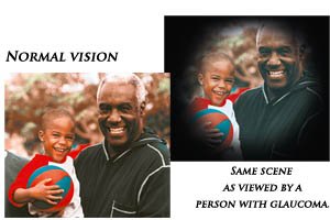 Early detection means vision protection... Early detection means vision protection...