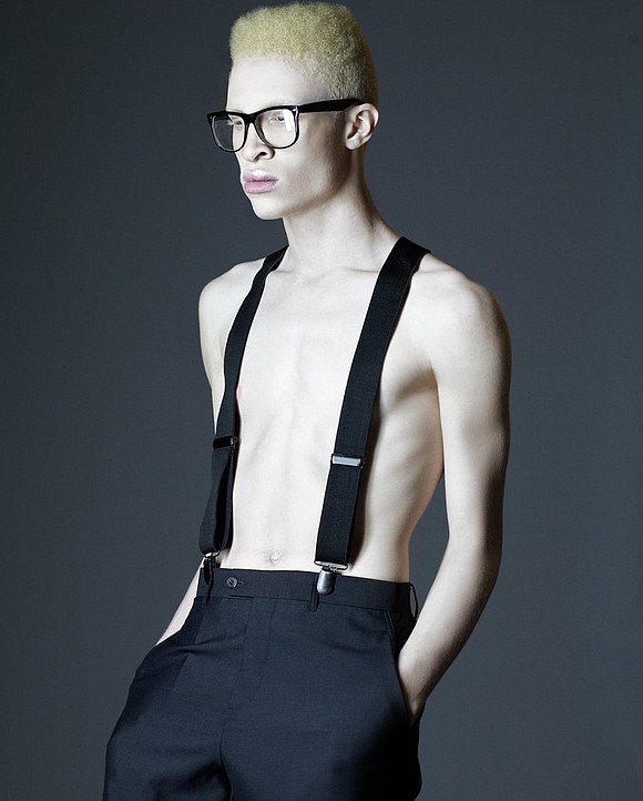 Shaun Ross The First Male Albino Model Citizen Newspaper Group Inc Premier African American Weekly
