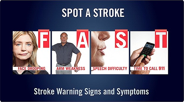 The primary stroke warning signs via the acronym FAST: Face Dropping, Arm Weakness, Speech Difficulty and Time to Call 911.  