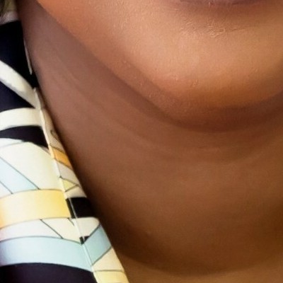 Tease photo