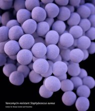 For the first time, the CDC is categorizing antibiotic-resistant organisms by threat level. That's because, in their conservative estimates, more than 2 million people get antibiotic-resistant infections each year, and at least 23,000 die because current drugs no longer stop their infections.