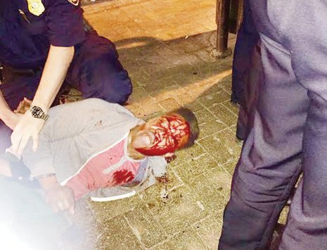 Bloodied University of Virginia student Martese Johnson is held down by an ABC agent after being slammed to the ground last week outside a Charlottesville pub.