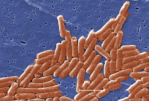 Twenty-four people in 16 states were infected with a strain of salmonella from March through June in an outbreak linked …
