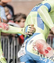 Injured riders Michael Valgren, left, and Michael Rogers of the Russian Team Tinkoff-Saxo show that competitive bike racing isn’t for the weak or faint of heart. The two fell on the course Sunday after the tires on their bikes touched.