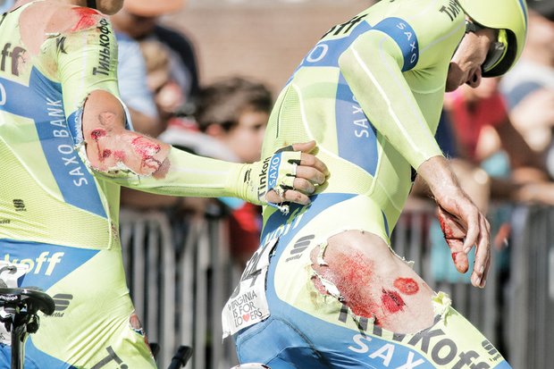 Injured riders Michael Valgren, left, and Michael Rogers of the Russian Team Tinkoff-Saxo show that competitive bike racing isn’t for the weak or faint of heart. The two fell on the course Sunday after the tires on their bikes touched.