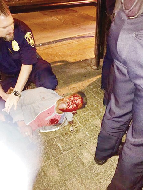 This photo taken by bystander Bryan Beaubrun shows the bloodied Martese Johnson as an officer holds down the University of Virginia honors student during his arrest March 18 outside a Charlottesville pub.   
