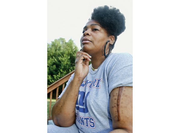 S.F. Braxton bears the scar of the vicious knife attack that changed her life. She has not been able to return to work since she was stabbed April 14, 2015.
￼