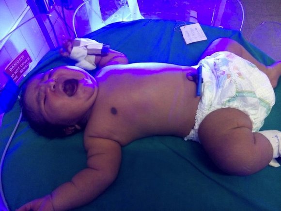 A young woman in India has given birth to a 15-pound baby girl, which doctors believe is the country's heaviest ... A young woman in India has given birth to a 15-pound baby girl, which doctors believe is the country's heaviest ...