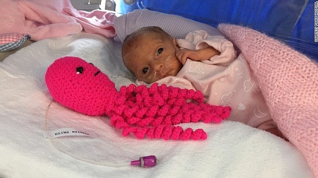 Inside neonatal intensive care unit (NICU) incubators at Poole Hospital United Kingdom hospital, premature babies have an unlikely companion -- colorful, crocheted octopi. These crocheted ocotpi are used as a form of therapy to help comfort premature babies.