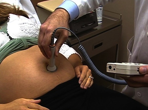 	A Texas bill would prevent parents from suing their doctor if their baby is born with a disability
