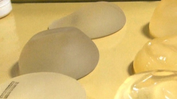 Nine deaths have been reported to the US Food and Drug Administration, stemming from a rare cancer that is associated with breast implants.