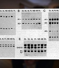 Genetic changes and variants linked to the development of brain and ovarian cancers have been discovered in two new studies. This significant development offers researchers the chance to understand more about how these cancers develop and how they may one day be treated, or even prevented.