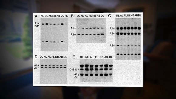 Genetic changes and variants linked to the development of brain and ovarian cancers have been discovered in two new studies. …