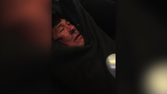 The passenger forcefully removed from a United Airlines flight this week has a concussion and broken nose, his attorney told …