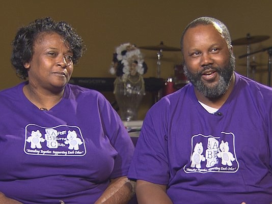 Justina and James Page aren't doctors or nurses, but they can help burn victims heal, because they're burn victims themselves.