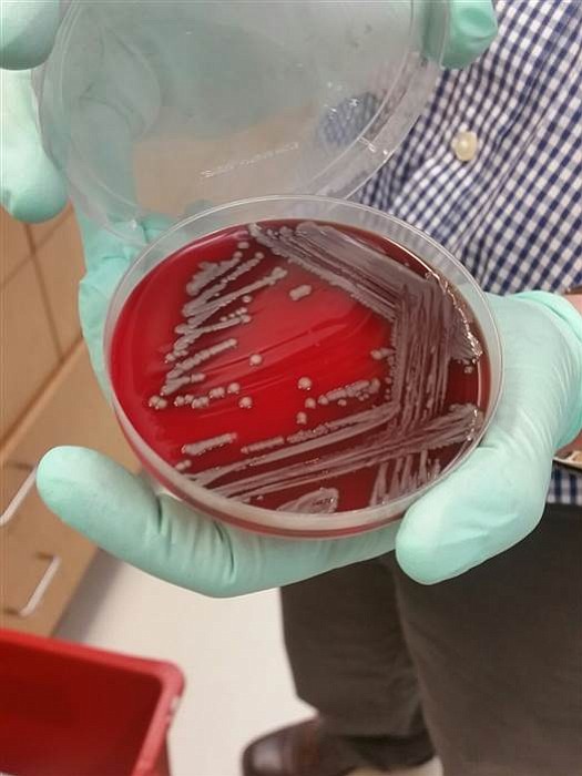 A dangerous strain of antibiotic-resistant bacteria is far more common in Houston than anyone knew and shows signs it can …