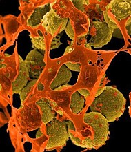 Scientists in the United States have developed a vital tool in the battle against superbugs by re-engineering a decades-old antibiotic.