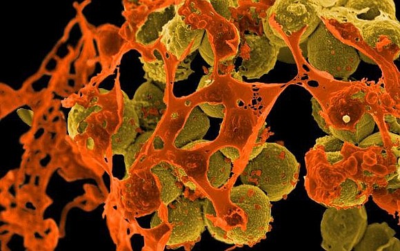 Scientists in the United States have developed a vital tool in the battle against superbugs by re-engineering a decades-old antibiotic.