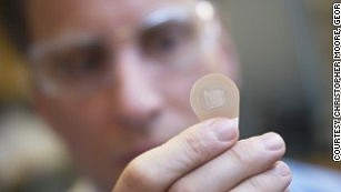 Mark Prausnitz, a Georgia Tech Regents professor in the School of Chemical and Biomolecular Engineering, holds a microneedle vaccine patch containing needles that dissolve into the skin.