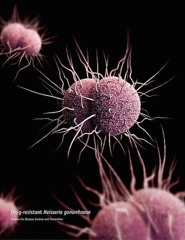 Neisseria Gonorrhoeae Bacteria