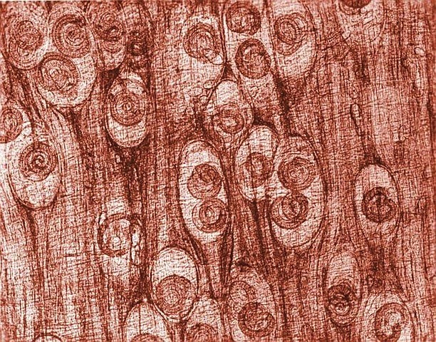 This is a photomicrograph depicting numbers of Trichinella spiralis cysts seen embedded in a muscle tissue specimen, in a case of trichinellosis, which was acquired by ingesting meat containing cysts (encysted larvae) of Trichinella sp. roundworm (nematode) parasites.