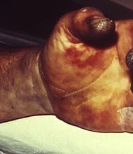 The spread of a plague outbreak in Madagascar, which began in August, has taken the lives of 133 people and resulted in 1,836 suspected or confirmed cases.