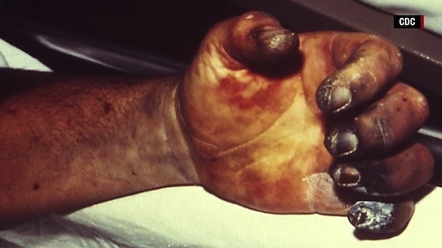 The spread of a plague outbreak in Madagascar, which began in August, has taken the lives of 133 people and resulted in 1,836 suspected or confirmed cases.