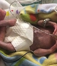 Courtney Stensrud and her husband call their fun-loving, spunky daughter a miracle.The now 3-year-old girl was born at just 21 weeks and four days after conception. "She may be the most premature known survivor to date," according to a case report about her birth published in the journal Pediatrics on Thursday.