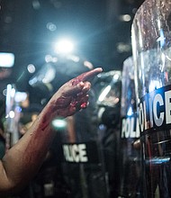 With blood covering her hand and arm, a woman points at a police officer on September 21, 2016 in Charlotte, NC. (Sean Rayford/Getty Images)