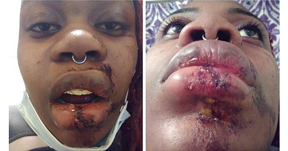 Diamond Rust, a 20-year-old woman from Southeast Washington, DC, was slammed on the ground and brutally arrested by a Metro …