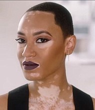 Amy Deanna becomes CoverGirl's first model with vitiligo. (CoverGirl)
