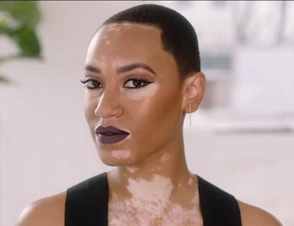 Amy Deanna is breaking barriers thanks to CoverGirl. For the first time, CoverGirl is featuring a model with vitiligo in …