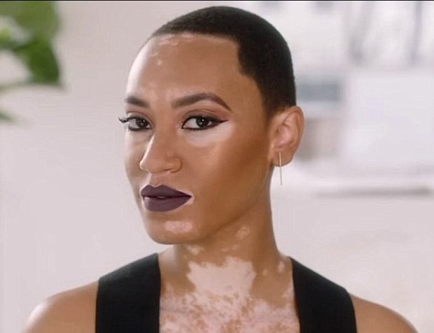 Amy Deanna becomes CoverGirl's first model with vitiligo. (CoverGirl)