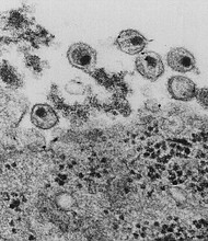 Milwaukee is seeing an unexpected spike in cases of HIV and other sexually transmitted diseases, according to health officials.
Source:	CDC