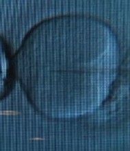 An Ohio fertility clinic says more than 4,000 eggs and embryos were affected by a freezer malfunction, double the number previously thought -- and that it's unlikely any of them are viable.