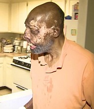   Robert Chelsea is seen at his home in Los Angeles on June 8, 2018.