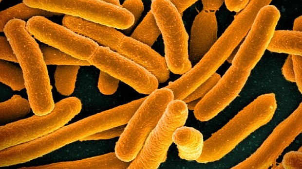 	E.coli