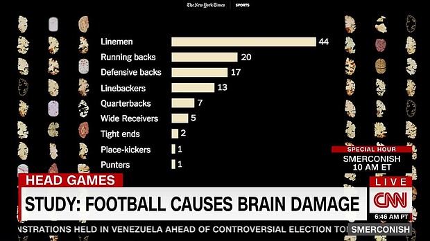 University of North Carolina football coach Larry Fedora is under fire after he questioned the validity of studies on a degenerative brain illness that affects players