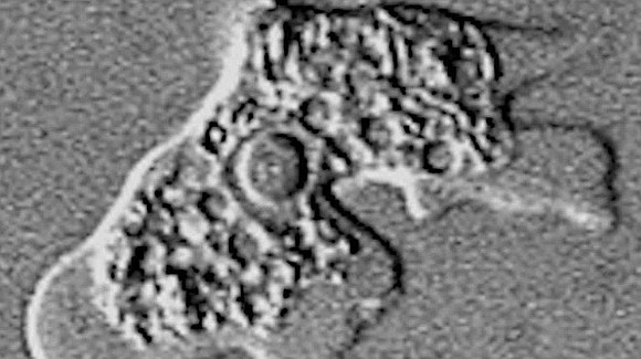 After a 29-year-old man died from an infection with what's commonly known as brain-eating amoeba, health officials are investigating the …