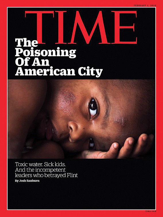 A 2016 photograph by Free Press photographer Regina H. Boone of a toddler afflicted by the contaminated water in Flint, ...