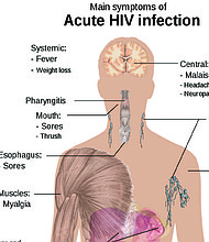 Black Americans have been disproportionately impacted by HIV and AIDS since the epidemic’s beginning, and that disparity has deepened over time.